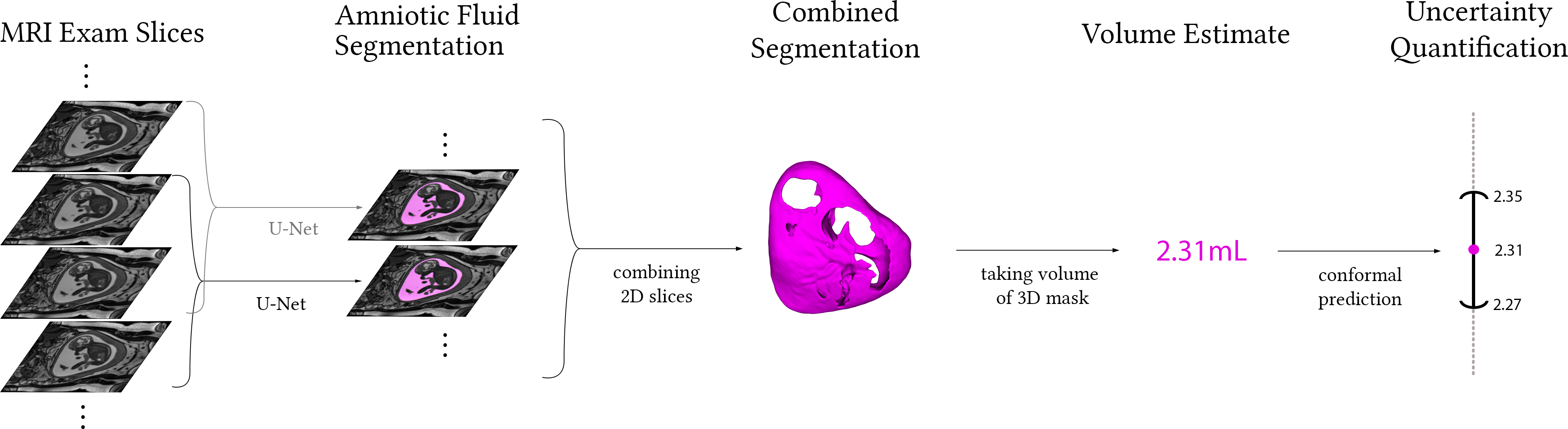 AmnioML pipeline diagram.